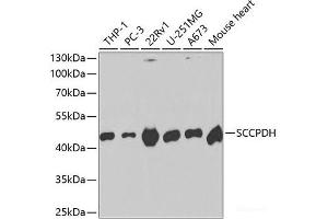 Western blot analysis of extracts of various cell lines using SCCPDH Polyclonal Antibody at dilution of 1:1000. (SCCPDH 抗体)