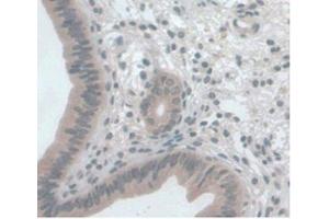 DAB staining on IHC-P Samples:Mouse Uterus Tissue) (CCL2 抗体  (AA 24-96))