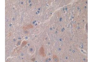 Detection of IL18BP in Rat Spinal cord Tissue using Polyclonal Antibody to Interleukin 18 Binding Protein (IL18BP) (IL18BP 抗体  (AA 29-193))