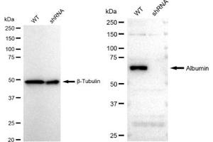 Western blotting analysis using Albumin antibody (ABIN7797549).