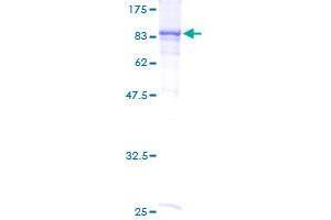 RIOK2 Protein (AA 1-552) (GST tag)
