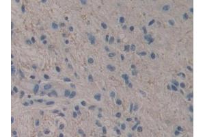 Immunohistochemistry (IHC) image for anti-R-Spondin 3 (RSPO3) (AA 22-272) antibody (ABIN7430150)