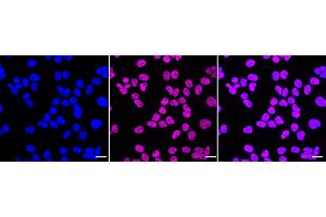 Immunocytochemical staining of HeLa cells with C-terminal binding protein 2 antibody (ABIN7797816), 1:1,000).