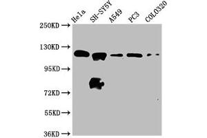 Western Blot Positive WB detected in: Hela whole cell lysate, SH-SY5Y whole cell lysate, A549 whole cell lysate, PC-3 whole cell lysate, COLO320 whole cell lysate All lanes: MAML2 antibody at 2. (MAML2 抗体  (AA 347-506))