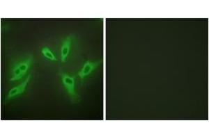 Immunofluorescence analysis of HeLa cells, using TUSC3 Antibody. (TUSC3 抗体  (AA 131-180))