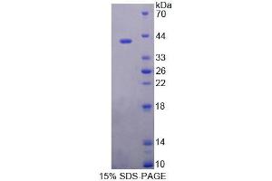 SDS-PAGE analysis of Mouse ERP44 Protein. (ERP44 蛋白)