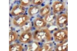 Used in DAB staining on fromalin fixed paraffin-embedded Kidney tissue (PAFAH1B3 抗体  (AA 1-232))