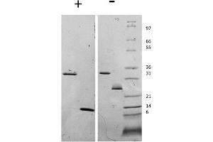 SDS-PAGE of Human Myostatin Propeptide Recombinant Protein SDS-PAGE of Human Myostatin Propeptide and Myostatin Recombinant Protein. (Myostatin Propeptide 蛋白)