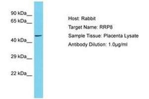 Image no. 1 for anti-Ribosomal RNA Processing 8 (RRP8) (AA 100-149) antibody (ABIN6750590) (RRP8 抗体  (AA 100-149))