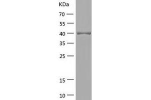 Alcohol Dehydrogenase (ADH) (AA 1-375) protein (His tag)