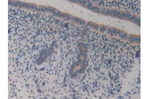 Detection of GAB3 in Mouse Uterus Tissue using Polyclonal Antibody to GRB2 Associated Binding Protein 3 (GAB3) (GAB3 抗体  (AA 142-375))