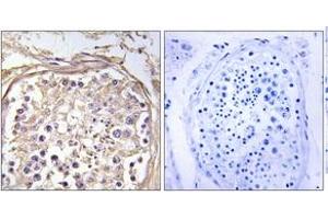 Immunohistochemistry analysis of paraffin-embedded human testis tissue, using CHST9 Antibody. (CHST9 抗体  (AA 361-410))