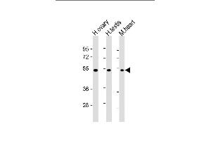 All lanes : Anti-VEGF3 Antibody at 1:2000 dilution Lane 1: human ovary lysate Lane 2: human testis lysate Lane 3: mouse heart lysate Lysates/proteins at 20 μg per lane. (VEGFC 抗体  (C-Term, N-Term))