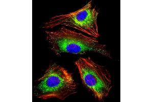 Immunofluorescent analysis of 4% paraformaldehyde-fixed, 0. (LAMP1 抗体)