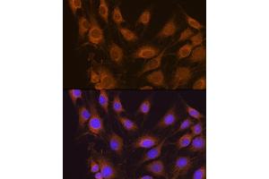 Immunofluorescence analysis of C6 cells using SEL1L antibody (ABIN6132642, ABIN6147499, ABIN6147500 and ABIN6215644) at dilution of 1:100. (SEL1L 抗体  (AA 22-190))