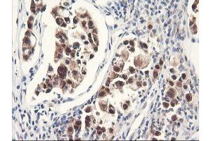 Image no. 5 for anti-F-Box Protein 21 (FBXO21) antibody (ABIN1498231) (FBXO21 抗体)