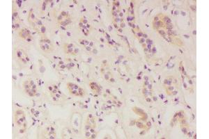 Formalin-fixed and paraffin embedded human kidney labeled with Anti-IFNAR1 Polyclonal Antibody, Unconjugated  at 1:300 followed by conjugation to the secondary antibody and DAB staining. (IFNAR1 抗体  (AA 351-450))