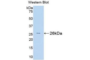 Detection of Recombinant Bid, Rat using Polyclonal Antibody to BH3 Interacting Domain Death Agonist (Bid) (BID 抗体  (AA 1-196))