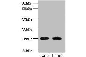 Western blot All lanes: CEACAM4 antibody at 1. (CEACAM4 抗体  (AA 36-155))