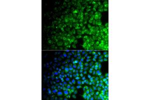 Immunofluorescence analysis of A549 cell using USP10 antibody. (USP10 抗体)