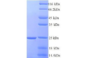 SDS-PAGE (SDS) image for Hematological and Neurological Expressed 1 (HN1) (AA 2-154) protein (His tag) (ABIN5714508) (HN1 Protein (AA 2-154) (His tag))