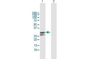 Western Blot analysis of PPP1R2P3 expression in transfected 293T cell line by PPP1R2P3 MaxPab polyclonal antibody. (PPP1R2P3 抗体  (AA 1-205))