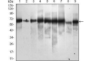 Western blot analysis using SQSTM1 mouse mAb against Hela (1), Jurkat (2), THP-1 (3), HEK293 (4), A549 (5), MCF-7 (6), HepG2 (7), COS7 (8) and SK-BR-3 (9) cell lysate. (SQSTM1 抗体  (AA 232-356))