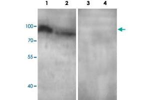 Western blot analysis of human tissue lysate with ADCY3 polyclonal antibody  at 1:500 dilution.