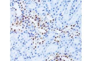 Immunohistochemistry of paraffin-embedded Rat kidney using ANP32A Polyclonal Antibody at dilution of 1:100 (40x lens). (PHAP1 抗体)