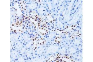 Immunohistochemistry of paraffin-embedded Rat kidney using ANP32A Polyclonal Antibody at dilution of 1:100 (40x lens). (PHAP1 抗体)