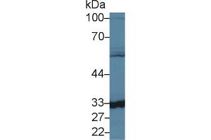 Detection of CA5B in Mouse Liver lysate using Polyclonal Antibody to Carbonic Anhydrase VB, Mitochondrial (CA5B) (CA5B 抗体  (AA 63-225))