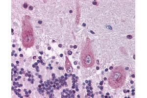 Anti-KIF21A antibody IHC of human brain, cerebellum. (KIF21A 抗体  (AA 551-600))