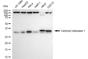 Western blotting analysis using Carbonyl reductase 1 antibody (ABIN7797872).
