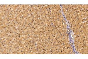 Immunohistochemistry (IHC) image for anti-Clusterin (CLU) (AA 229-446) antibody (ABIN7436996)