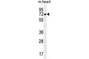 CCDC148 Antibody (Center) western blot analysis in mouse heart tissue lysates (35µg/lane). (CCDC148 抗体  (Middle Region))