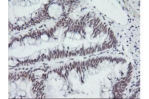 Image no. 1 for anti-SEC14 and Spectrin Domains 1 (SESTD1) antibody (ABIN1501066)