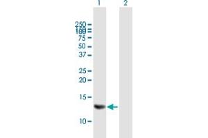 Western Blot analysis of MRPS6 expression in transfected 293T cell line by MRPS6 MaxPab polyclonal antibody. (MRPS6 抗体  (AA 1-125))