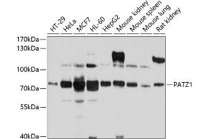 Western blot analysis of extracts of various cell lines, using P antibody (ABIN6132856, ABIN6145252, ABIN6145253 and ABIN6214168) at 1:1000 dilution. (PATZ1 抗体  (AA 250-350))