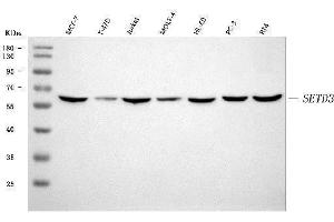 Western blot analysis of SETD3 using anti-SETD3 antibody (ABIN7600293).