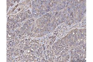 IHC analysis of ANXA4 using anti-ANXA4 antibody (ABIN5518805).