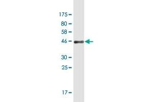 Western Blot detection against Immunogen (44. (RNASEH2C 抗体  (AA 1-164))