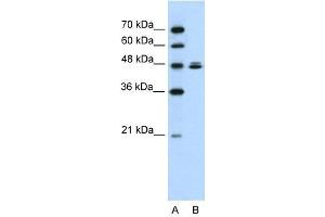 Western Blot showing HSPBAP1 antibody used at a concentration of 1-2 ug/ml to detect its target protein.