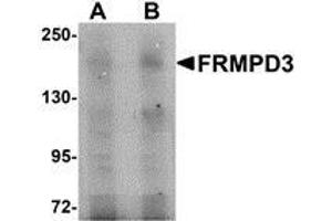 Western blot analysis of FRMPD3 in Jurkat cell lysate with AP30348PU-N FRMPD3 antibody at (A) 1 and (B) 2 μg/ml. (FRMPD3 抗体  (Center))