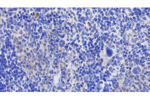 Detection of GPX1 in Mouse Spleen Tissue using Polyclonal Antibody to Glutathione Peroxidase 1 (GPX1) (Glutathione Peroxidase 1 抗体  (AA 48-201))