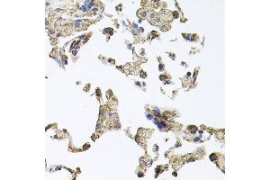 Immunohistochemistry of paraffin-embedded human lung using PKN1 antibody. (PKN1 抗体)