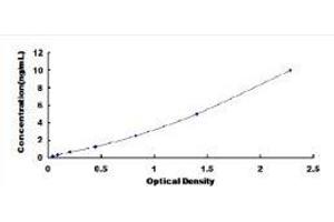 Typical standard curve (IL1R1 ELISA 试剂盒)