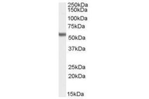 Image no. 2 for anti-Forkhead Box C1 (FOXC1) (C-Term) antibody (ABIN374336) (FOXC1 抗体  (C-Term))