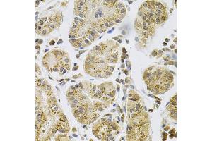 Immunohistochemistry of paraffin-embedded human stomach using PSEN1 Antibody (ABIN5971213) at dilution of 1/100 (40x lens). (Presenilin 1 抗体)