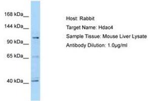 Image no. 1 for anti-Histone Deacetylase 4 (HDAC4) (C-Term) antibody (ABIN6749909) (HDAC4 抗体  (C-Term))