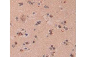 Immunohistochemistry (Paraffin-embedded Sections) (IHC (p)) image for anti-Peptidyl Prolyl Cis/Trans Isomerase NIMA Interacting 4 Protein (PIN4) (AA 23-130) antibody (ABIN2919542)